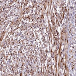 SSC5D Antibody, Novus Biologicals 25 &mu;L, Unlabeled:Antibodies, Polyclonal